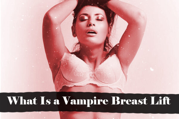 What Is a Vampire Breast Lift — A Comprehensive Guide