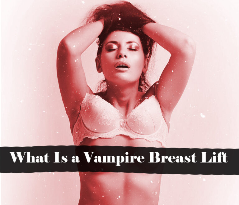 What Is a Vampire Breast Lift? — A Comprehensive Guide